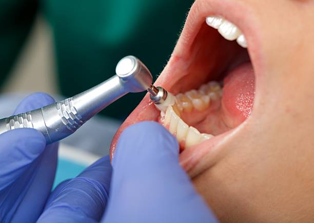 Oral Surgery in Millington, NJ